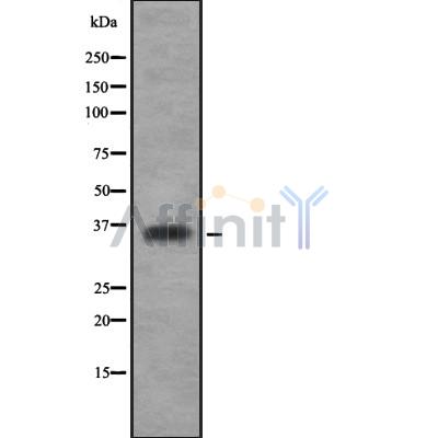 OR52N2 Antibody - Western blot analysis OR52N2 using HUVEC whole cell lysates.