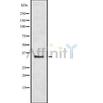 OR56A4/5 Antibody - Western blot analysis OR56A4/5 using HUVEC whole cell lysates.
