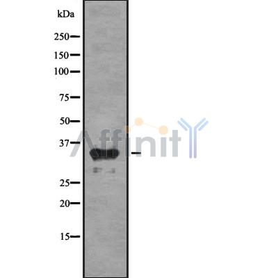 OR1C1 Antibody - Western blot analysis OR1C1 using COLO205 whole cell lysates.
