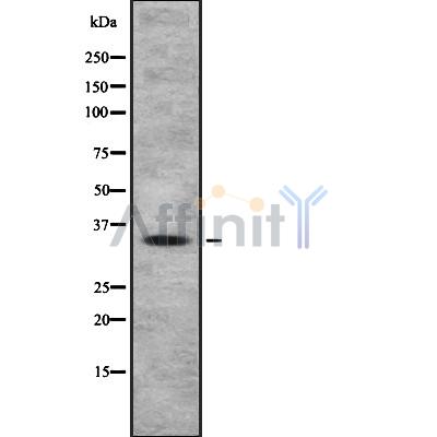 OR4A47 Antibody - Western blot analysis OR4A47 using HeLa whole cell lysates.