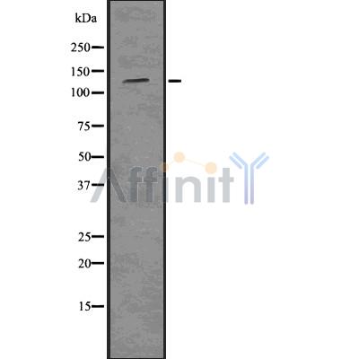 TIE2 Antibody - Western blot analysis of Tie-2 using HUVEC whole cell lysates.