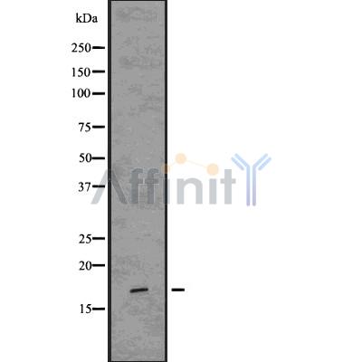 Caveolin 3 Antibody - Western blot analysis of Caveolin 3 using HepG2 whole cell lysates.