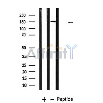 MSH6 Antibody - Western blot analysis of MSH6 using Mouse spleen lysate.
