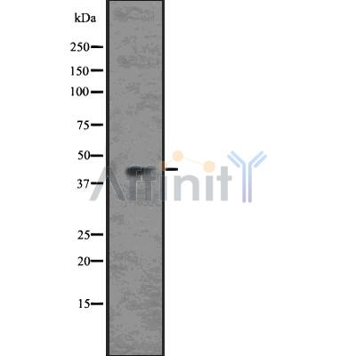 Wnt5a Antibody - Western blot analysis of Wnt5a using HT-29 whole cell lysates.