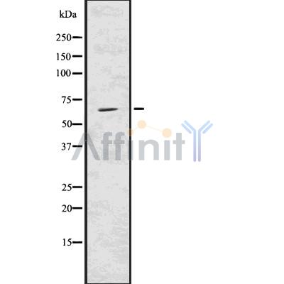 USP22 Antibody - Western blot analysis USP22 using HeLa whole cell lysates.