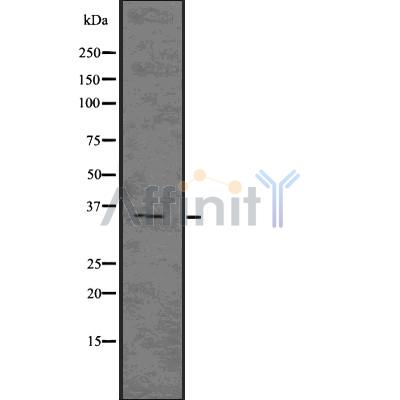 NCR1 Antibody - Western blot analysis NKp46 using COLO205 whole cell lysates.