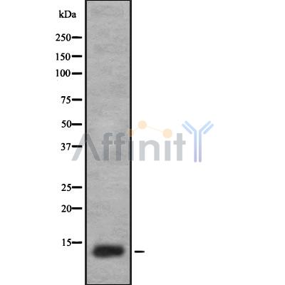 LY6A Antibody - Western blot analysis of LY6A using A549 whole cell lysates.