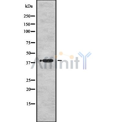 MBNL1 Antibody - Western blot analysis of MBNL1 using HuvEc whole cell lysates.