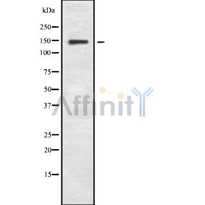 MYBPC3 Antibody - Western blot analysis of MYBPC3 using Jurkat whole cell lysates.