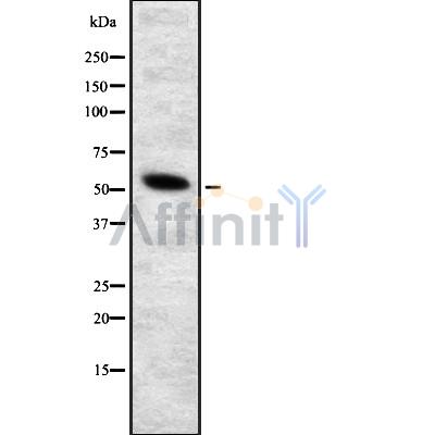 GRB7 Antibody - Western blot analysis GRB7 using COLO205 whole cell lysates.
