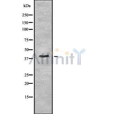 PYGO2 Antibody - Western blot analysis of PYGO2 using HuvEc whole cell lysates.