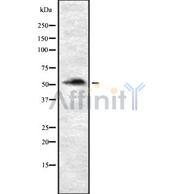P4HTM Antibody - Western blot analysis of P4HTM using Jurkat whole cell lysates.