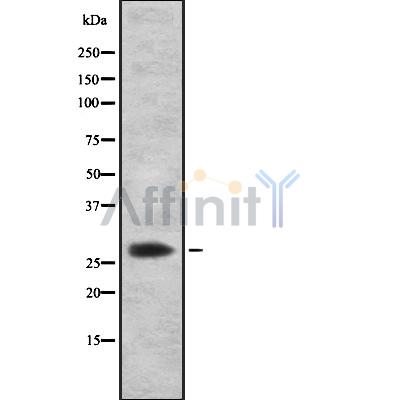 CITED2 Antibody - Western blot analysis of CITED2 using HeLa whole cell lysates.