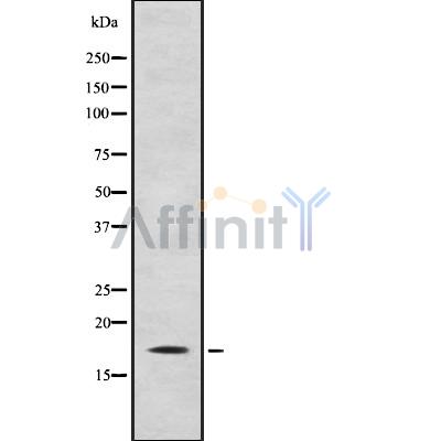 CITED4 Antibody - Western blot analysis of CITED4 using K562 whole cell lysates.