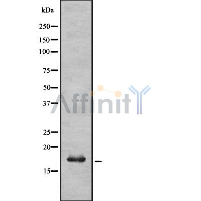 UBE2L6 Antibody - Western blot analysis UBE2L6 using K562 whole cell lysates.