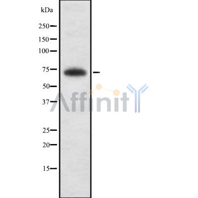 ZBTB33 Antibody - Western blot analysis of ZBTB33 using COLO205 whole cell lysates.