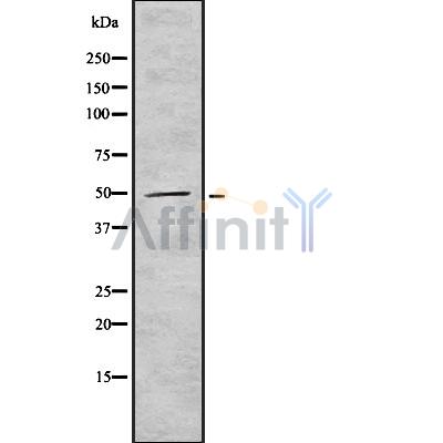SOX1 Antibody - Western blot analysis SOX1 using HeLa whole cell lysates.