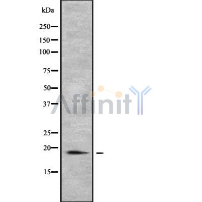 PTRH2 Antibody - Western blot analysis of PTRH2 using COLO205 whole cell lysates.