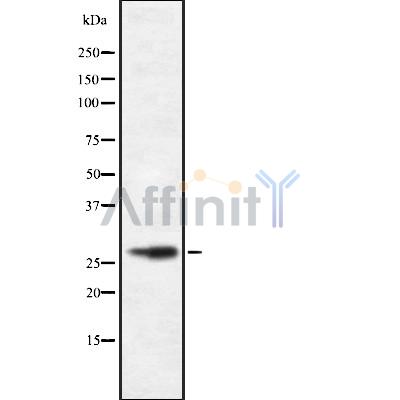 CD48 Antibody - Western blot analysis of CD48 using HeLa whole cell lysates.