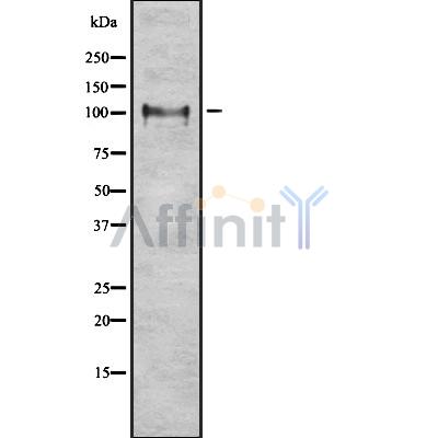 ITCH Antibody - Western blot analysis ITCH using LOVO whole cell lysates.