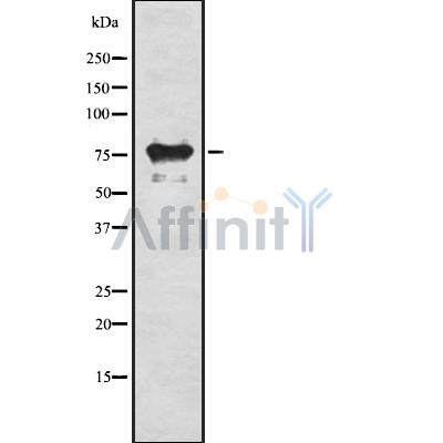 RIPK1 Antibody - Western blot analysis of RIPK1 using HeLa whole cell lysates.
