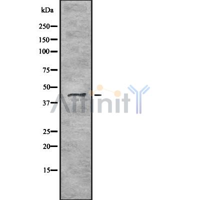 TRAM2 Antibody - Western blot analysis of TRAM2 using HeLa whole cell lysates.