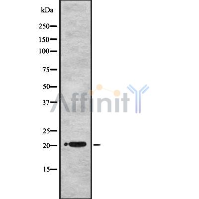 UBE2M Antibody - Western blot analysis of UBE2M Antibody expression in 293T cells lysates.