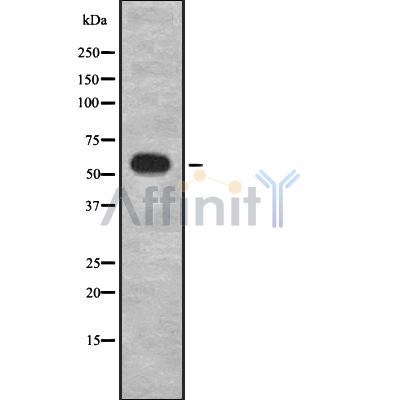 GRK1 Antibody - Western blot analysis GRK1 using HuvEc whole cell lysates.