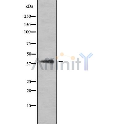 Galectin 8 Antibody - Western blot analysis of LGALS8 using A549 whole cell lysates.