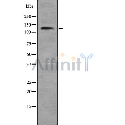 WAPAL Antibody - Western blot analysis of WAPAL using Jurkat whole cell lysates.