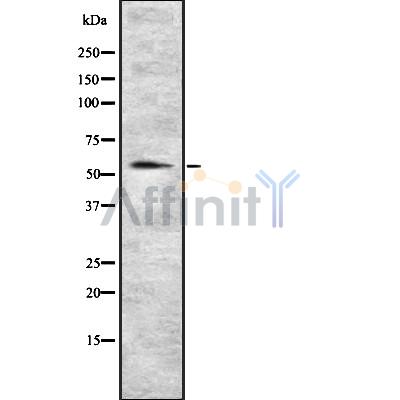 SERPINA6 Antibody - Western blot analysis SERPINA6 using COLO205 whole cell lysates.