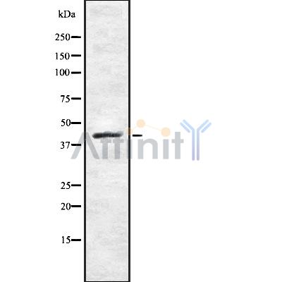 NR2E1 Antibody - Western blot analysis NR2E1 using HeLa whole cell lysates.