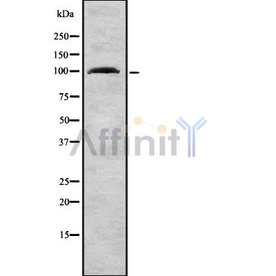 TNPO3 Antibody - Western blot analysis of TNPO3 using Jurkat whole cell lysates.