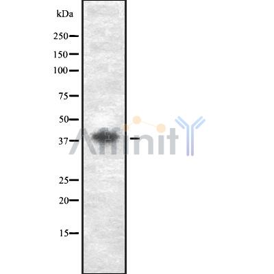 GDF3 Antibody - Western blot analysis GDF3 using Jurkat whole cell lysates.