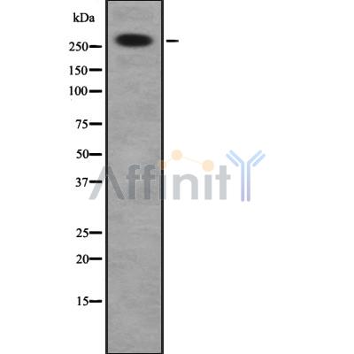 DSP Antibody - Western blot analysis of DSP using HuvEc whole cell lysates.