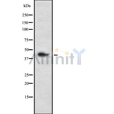 LHX3 Antibody - Western blot analysis of LHX3 using HepG2 whole cell lysates.