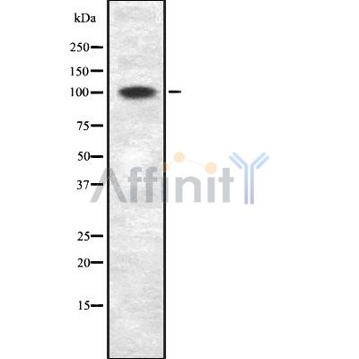 ZNF217 Antibody - Western blot analysis of ZNF217 using HT29 whole cell lysates.