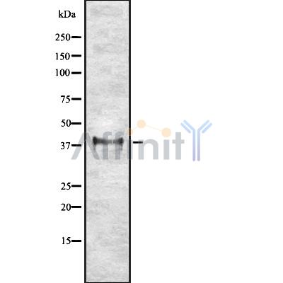 ETV2 Antibody - Western blot analysis of ETV2 using K562 whole cell lysates.