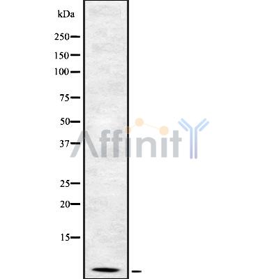 Defensin beta-2 Antibody - Western blot analysis of Defensin β2 using HuvEc whole cell lysates.