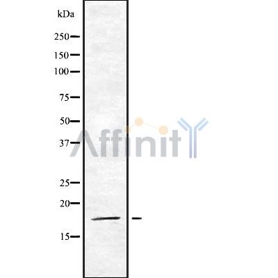 eIF5A2 Antibody - Western blot analysis of eIF5A2 using Jurkat whole cell lysates.