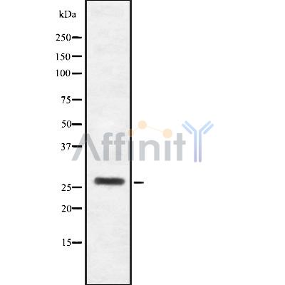HoxB4 Antibody - Western blot analysis of HoxB4 using Jurkat whole cell lysates.