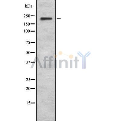 Nav1.6/SCN8A Antibody - Western blot analysis Na+ CP type VIII alpha using LOVO whole cell lysates.