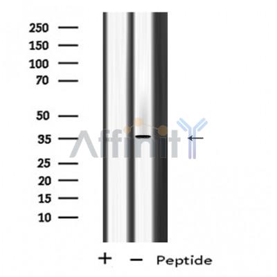 PP2A-C alpha/beta Antibody - Western blot analysis of PP2A-C alpha/β using MCF7 whole cell lysates.