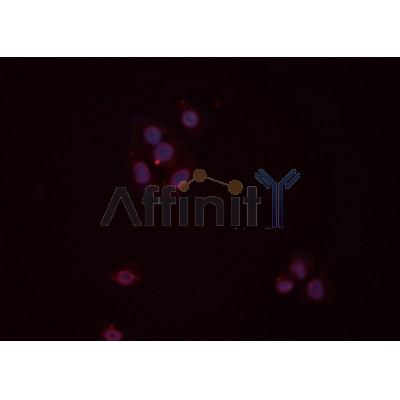 PP2A-C alpha/beta Antibody - DF8594 staining Hela cells by IF/ICC.
