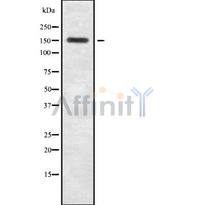 Tensin-2 Antibody - Western blot analysis of Tensin-2 using MCF7 whole cell lysates.