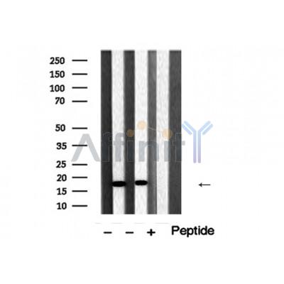 Cofilin Antibody - Western blot analysis of extracts from various samples, using Cofilin Antibody.