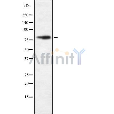 FAKD2 Antibody - Western blot analysis FAKD2 using HeLa whole cell lysates.