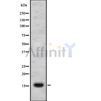 JTB Antibody - Western blot analysis of JTB using Jurkat whole cell lysates.