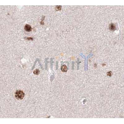 KIF20A Antibody - DF8671 at 1/100 staining human brain tissue by IHC-P.