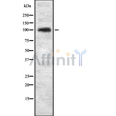 KIF20A Antibody - Western blot analysis of KIF20A using LOVO whole cell lysates.